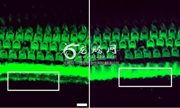 Treatment with a genome editing agent can preserve sound-detecting bristles in the inner ear of mice with genetic deafness (white box, left). Without the treatment, these bristles disappear (white box, right).