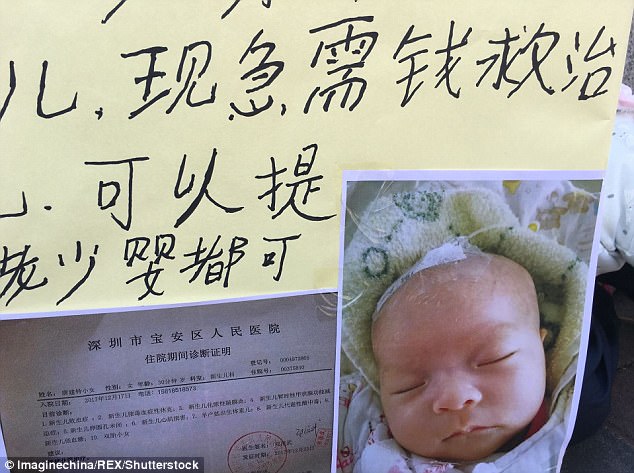 The couple need 100000 yuan (￡11262) to save their younger twin daughter (pictured)