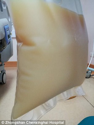 中山男子腹痛紧急送医抢救，检出“牛奶血”！