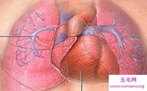 肺心病——了解肺源性心脏病的点点滴滴