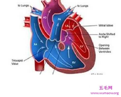 肺心病——了解肺源性心脏病的点点滴滴