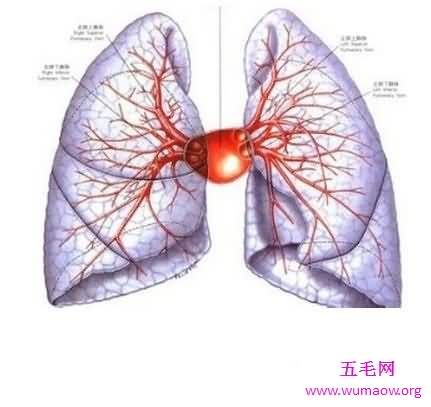 肺纤维化——它会让你的生活不再有色彩