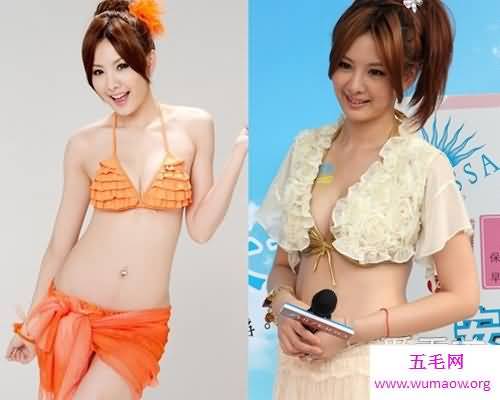 关于女人胸部的10个世界之最，最大的乳房重77斤