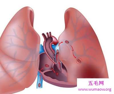 肝功能异常最常见表现有哪些 肝功能异常怎么办