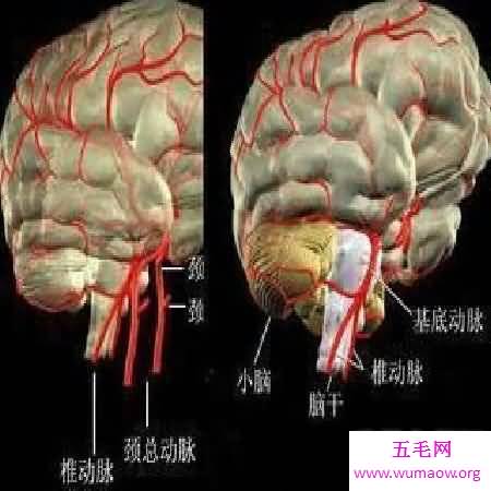  脑供血不足的那些事