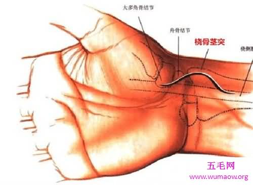 动脉血气分析是什么意思 它能提供什么样的信息