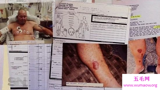 英国男子被雷劈死，瞬间变炭人(现场实图)