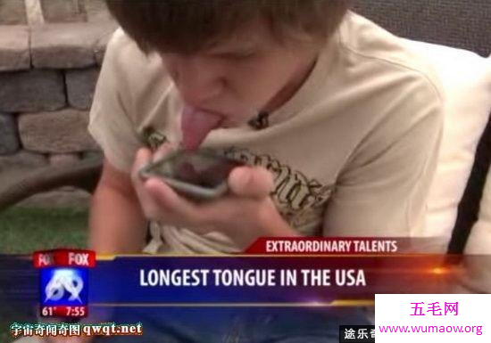 美国男孩9厘米的长舌头，能用舌头舔眼睛