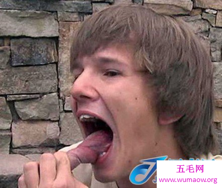 美国男孩9厘米的长舌头，能用舌头舔眼睛