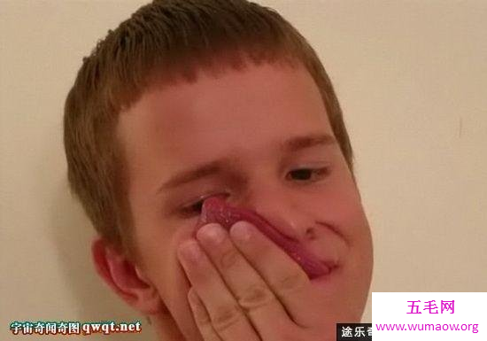 美国男孩9厘米的长舌头，能用舌头舔眼睛