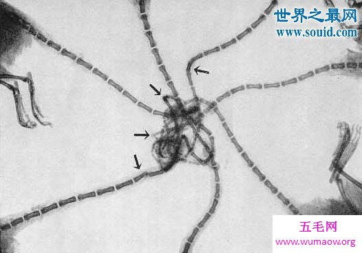 鼠王现象，无数只老鼠尾巴缠绕在一起(不祥预兆)