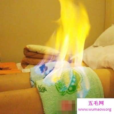 做好养生之为你揭秘火疗的功效与作用