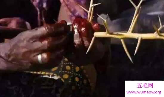 割礼是什么意思，割掉少男少女生殖器的残忍仪式