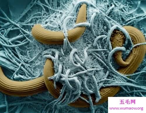 引发儿童病发率较高的一种寄生虫病蛔虫