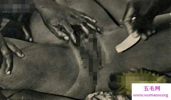 割礼是什么意思，割掉少男少女生殖器的残忍仪式