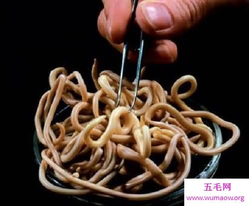 引发儿童病发率较高的一种寄生虫病蛔虫