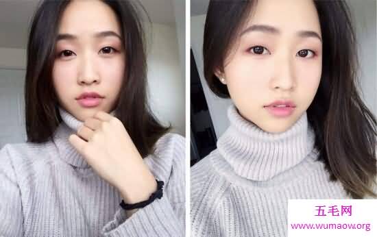 死鱼眼是什么样子的，现实中是由于大脑损伤造成的
