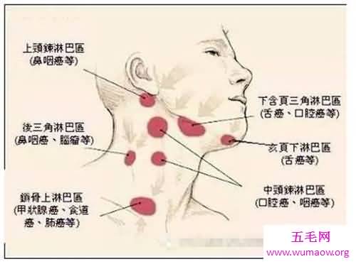 颈部淋巴结分区介绍 淋巴结肿大的原因介绍