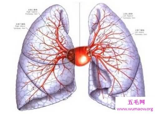 肺部纤维化病因原由介绍 症状以及治疗方法介绍