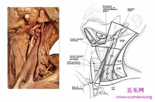颈部淋巴结分区介绍 淋巴结肿大的原因介绍