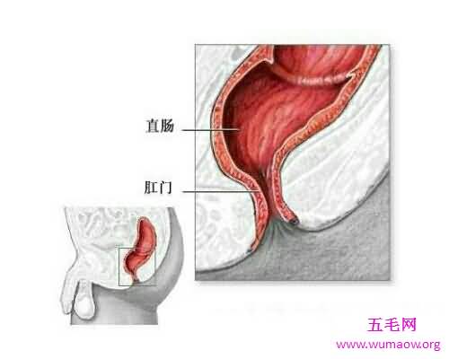 痔疮是一种非常痛苦的疾病 痔疮的症状是什么呢