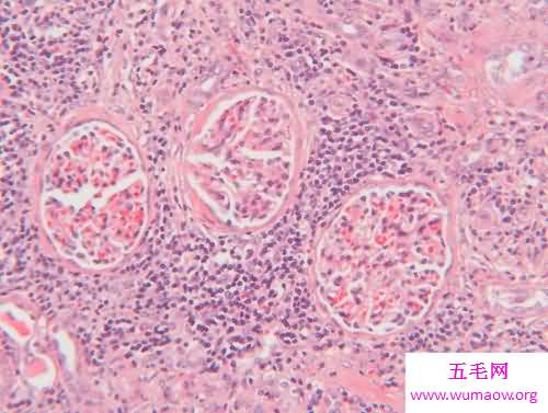 人体最大的器官是肝脏 最新发现的最大器官能分散癌症