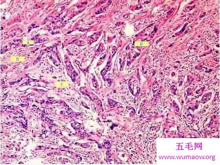 人体最大的器官是肝脏 最新发现的最大器官能分散癌症