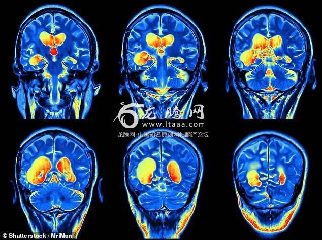 Chinese scientists are hunting for the human soul and are building a cutting edge MRI machine to find it. It is designed to provide a resolution 1000 times greater than existing MRI scanners and will allow scientists  to study the role of chemicals in the brain (stock)