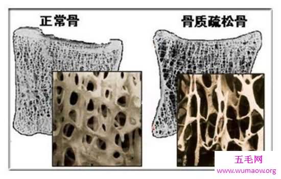 关于人体骨骼的十大事实，人体骨骼的这些奥秘你都知道吗？