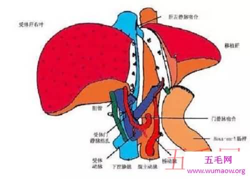 最早应用于人类的肾移植，对肾移植做出了巨大贡献