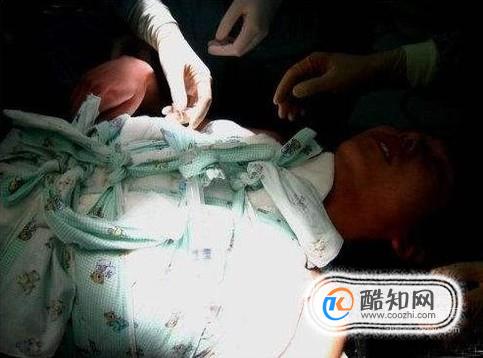 做了变性手术会缩短寿命？
