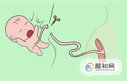 肚脐眼到底能不能抠