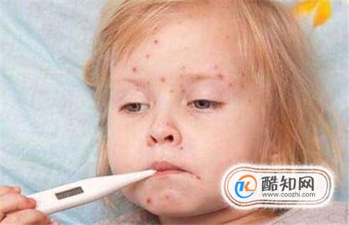 小孩子起水痘怎么办