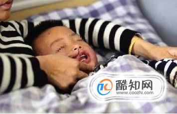 小孩吃辣条有哪些危害