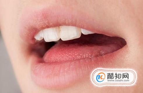 怎样改变用口呼吸的坏毛病