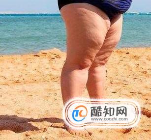 大象腿如何10天变铅笔腿