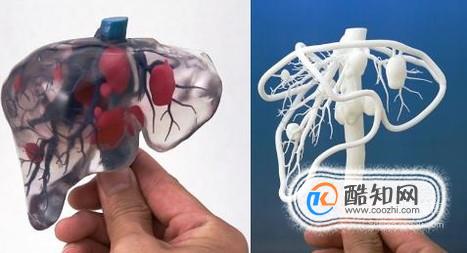 3D打印器官靠谱吗