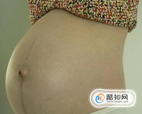 哪些人容易长妊娠纹