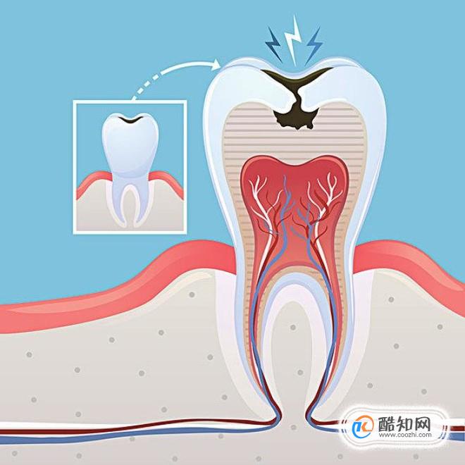 不刷牙给我们带来的坏处