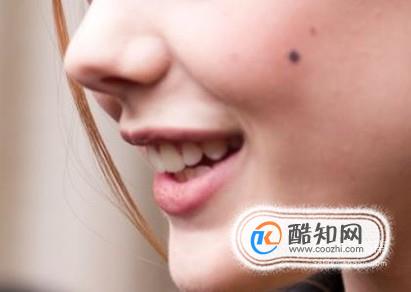点痣后的注意事项有哪些？
