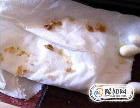 耳垢太多如何进行正确清除？