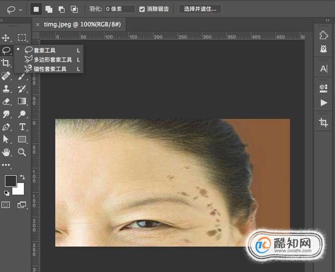 PS简单的给人物祛斑