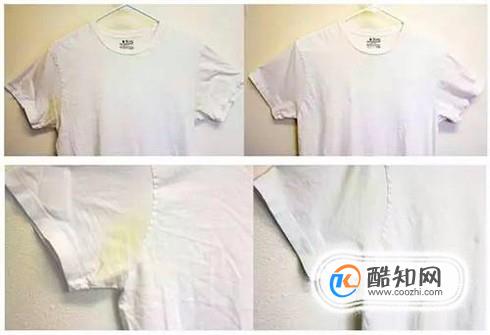 白衣服放久了发黄怎么办