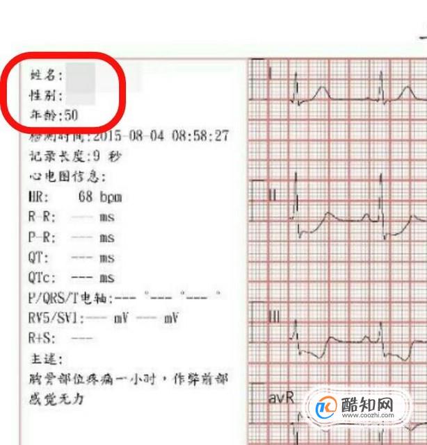 解读体检报告之心电图