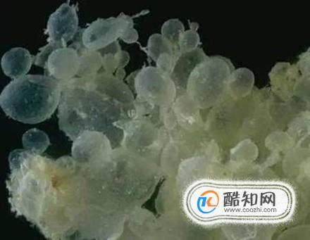 恶性葡萄胎是什么？有什么危害？