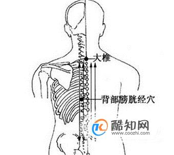 百病拔罐：咳嗽的拔罐疗法