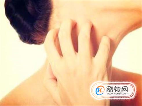 晚上睡觉身上痒怎么办