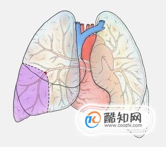 肺栓塞是什么病