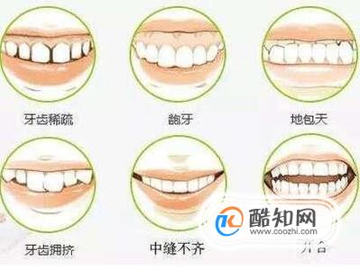 地包天牙齿矫正术后护理事项